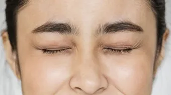 كيفية إزالة التجاعيد بين الحاجبين