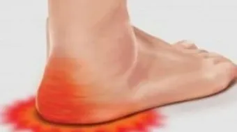 طريقة تنعيم كعب القدم