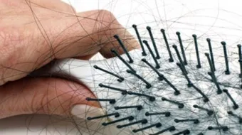 كيف اوقف تساقط الشعر