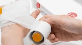 كيف تعالج الحروق