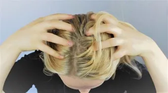 كيف تعالج قشرة الرأس