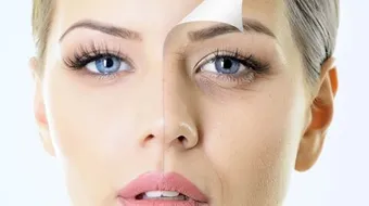 كيف أعالج تجاعيد العين