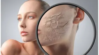 كيفية علاج بشرة الوجه