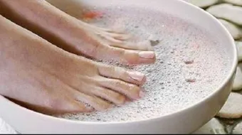 كيفية علاج تشققات القدمين