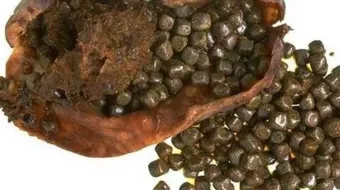 كيف تعالج حصى المرارة