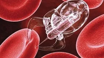 كيفية علاج سرطان الدم