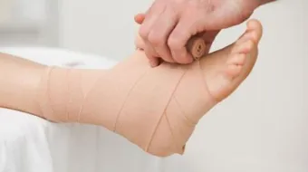 كيف تعالج تمزق الأربطة