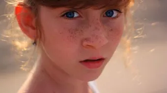 كيفية علاج الكلف