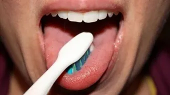 كيفية علاج فطريات الفم