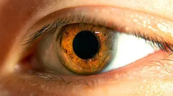 كيفية علاج قصر النظر