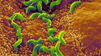 كيف أعالج جرثومة المعده