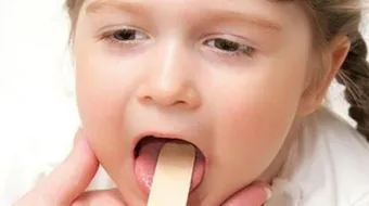 كيف أعالج ألم الحلق