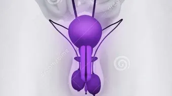 كيف تعالج دوالي الخصية