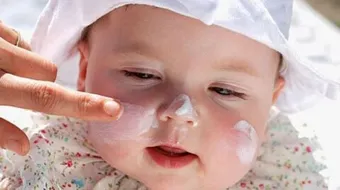 طريقة تبييض بشرة الأطفال