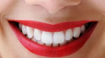 كيف تبيض اسنانك