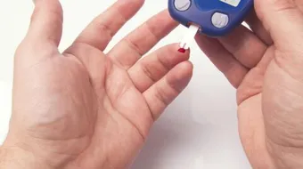 كسل الغدة الدرقية عند الاطفال