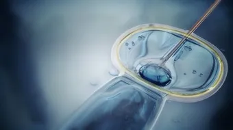 عملية الحقن المجهري