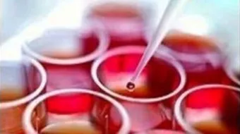 زيادة نسبة البوتاسيوم في الدم