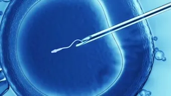 عملية الحقن الصناعي - فيديو