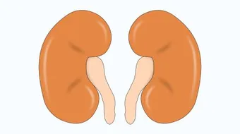 التهابات على الكلى