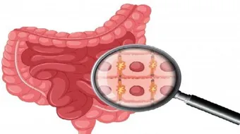 التهاب الأمعاء عند الأطفال