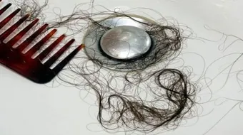 تفسير تساقط الشعر في الحلم