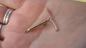 آثار اللولب الجانبية