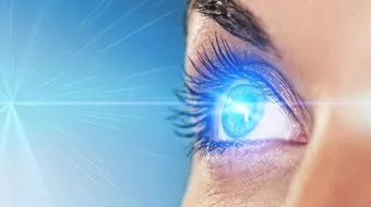 الآثار الجانبية لعملية الليزك