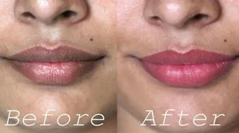 طرق تفتيح الشفاه