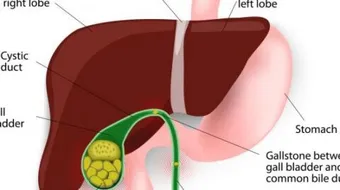 تضخم الكبد أسبابه وعلاجه