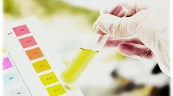 بحث عن الأحماض والقواعد