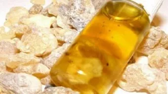 فوائد لبان الذكر للجسم