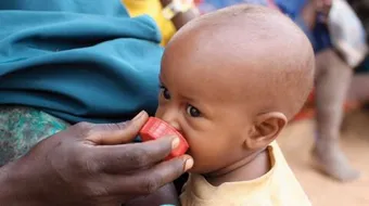 سوء التغذية والأمراض الناتجة عنها