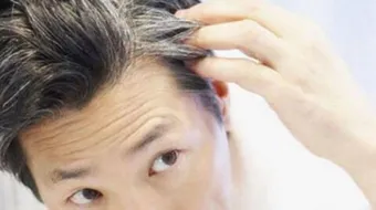 وسائل لإزالة الشيب