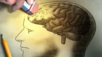 فقدان الذاكرة