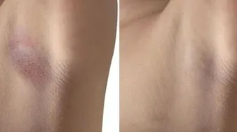 طريقة لتبيض الجسم