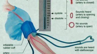 طريقة قياس ضغط الدم بدون جهاز