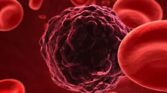 طرق تشخيص البكتيريا