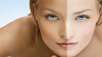 طرق تبييض البشرة الدهنية