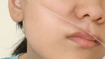 طرق نزع الشعر من الجسم