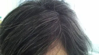 طرق علاج الشعر الأبيض