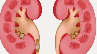 طرق الوقاية من الفشل الكلوي