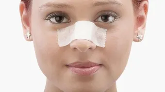 خلطة للتخلص من الرؤوس السوداء