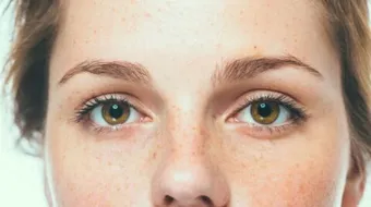 خلطة لإزالة النمش من الوجه