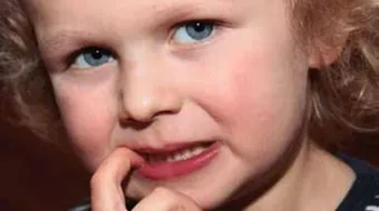 قضم الأظافر عند الأطفال