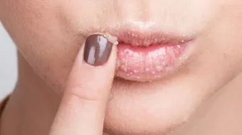 طرق نفخ الشفاه طبيعياً