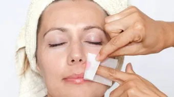 وصفات طبيعية لإزالة الشعر من الوجه