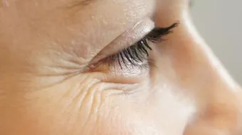 طرق طبيعية لإزالة التجاعيد