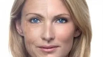 الجديد في تجميل تجاعيد الوجه والرقبة