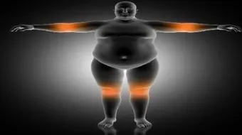 السمنة وصحة العظام